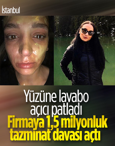 İstanbul'da yüzünde lavabo açıcı patladığını iddia etti: 1,5 milyonluk tazminat davası açtı