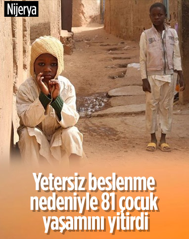 Nijerya'da yetersiz beslenme nedeniyle 81 çocuk yaşamını yitirdi