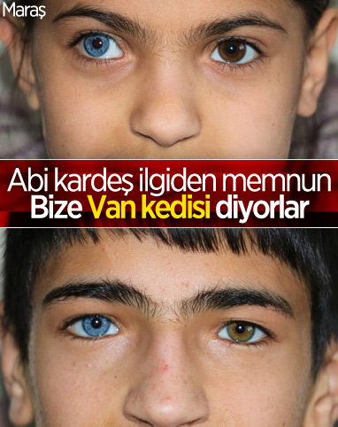 Kahramanmaraş'ta iki kardeş hayata çift renk bakıyor