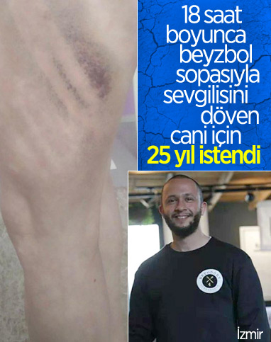 İzmir'de sevgiliye beyzbol sopasıyla şiddet: İddianame hazırlandı