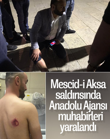 AA’nın Ortadoğu Editörü, Mescid-i Aksa saldırısında yaralandı