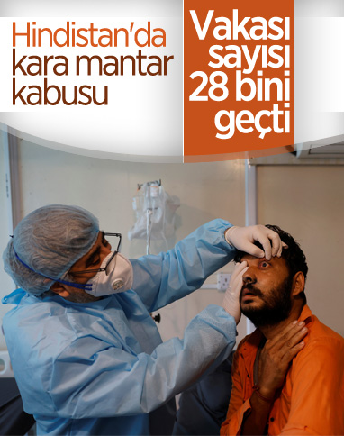 Hindistan’da kara mantar vakası sayısı 28 bini geçti