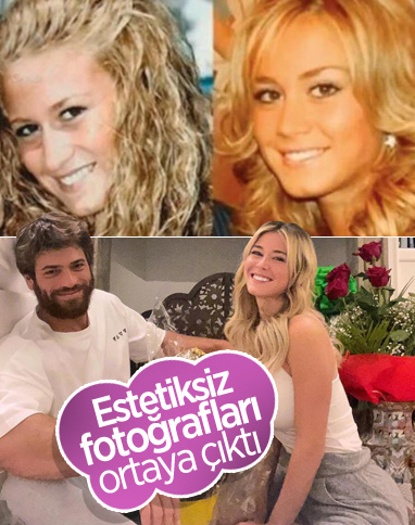Diletta Leotta’nın estetiksiz hali
