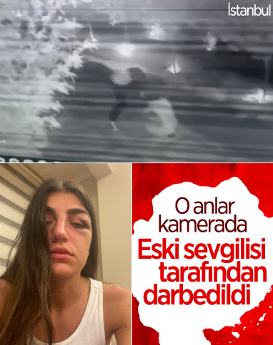 Manken Gizem Akbaş, eski sevgilisi tarafından darbedildi