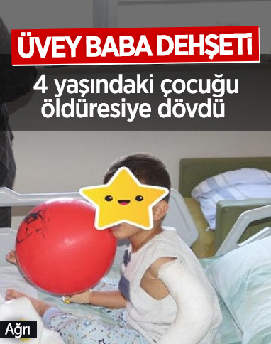 Ağrı'da 4 yaşındaki çocuk, üvey babası tarafından öldüresiye dövüldü