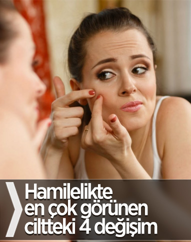 Hamilelikte en çok görünen ciltteki 4 değişim