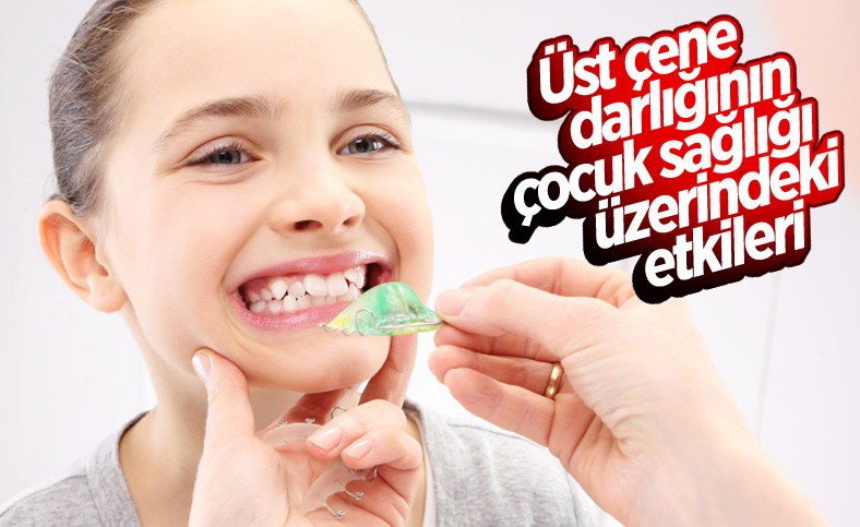 Çocuklarda üst çene darlığı uyku kalitesini düşürüyor