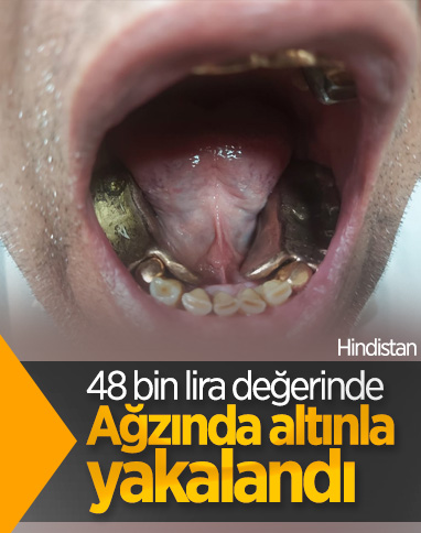 Hindistan'da takma diş kılığında altın taşıyan yolcu yakalandı