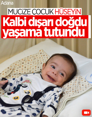Adana’da, kalbi dışarıda doğan ‘mucize bebek’ yaşama tutundu