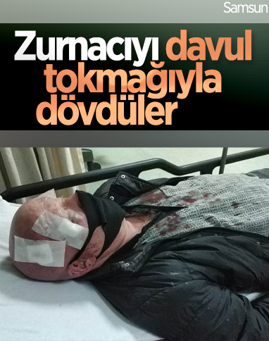 Samsun'da zurnacıyı hastanelik edip 10 bin lirasını gasbettiler