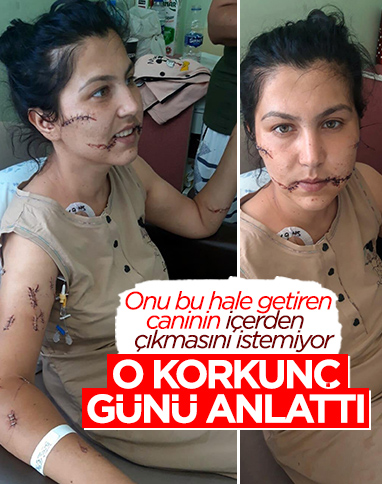 İzmir'de 104 yerinden bıçakladı, can çekişirken başında sigara içti