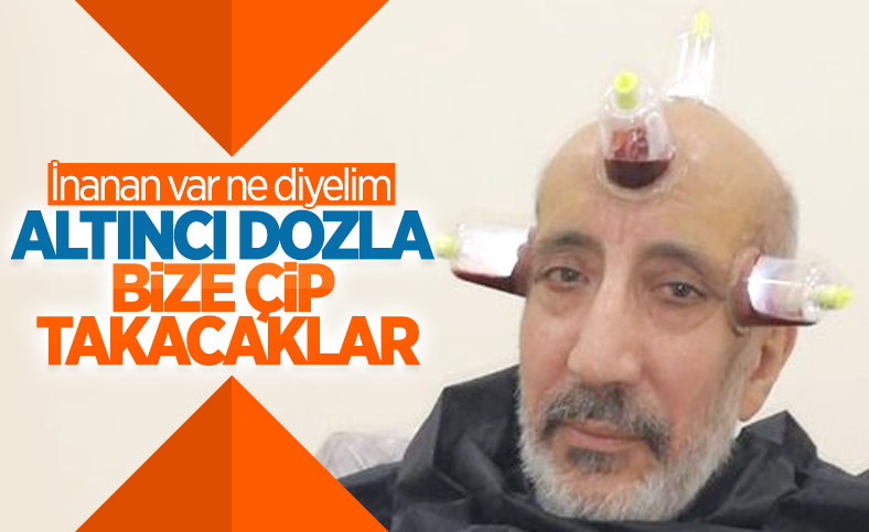 Abdurrahman Dilipak’tan çip iddiası