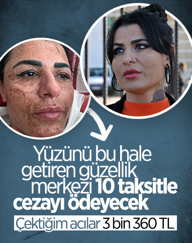 Antalya'da lazerde yüzü yanan kadının davasında sonuç çıktı