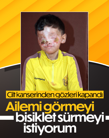 Erzurum'da cilt kanserinden gözleri kapanan Salih: Ailemi görmek istiyorum