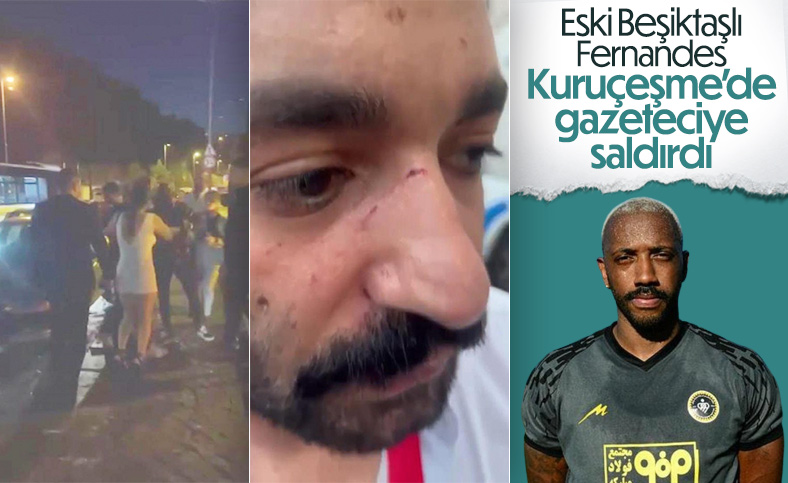 Manuel Fernandes, gazeteciye saldırdı