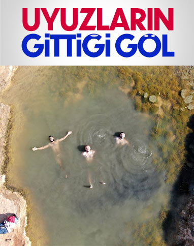 Sivas’taki gölün uyuzlara iyi geldiği iddia ediliyor