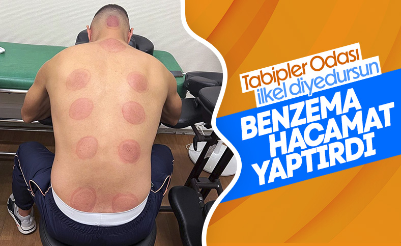 Karim Benzema hacamat yaptırdı