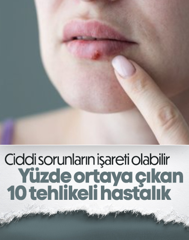 Yüzde ortaya çıkan 10 tehlikeli hastalık