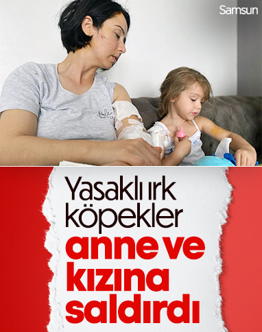 Samsun’da yasaklı ırk köpekler, anne ve 4 yaşındaki kızına saldırdı