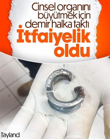 Tayland'da cinsel organına demir takınca hastanelik oldu