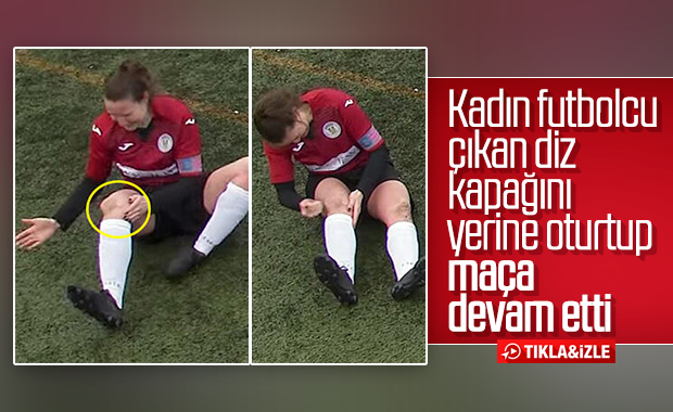 Diz kapağı çıkan kadın futbolcu maça devam etti