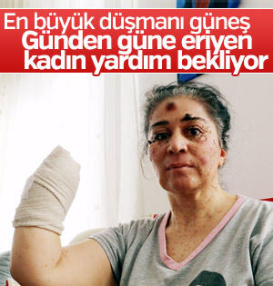 Güneşin erittiği kadın