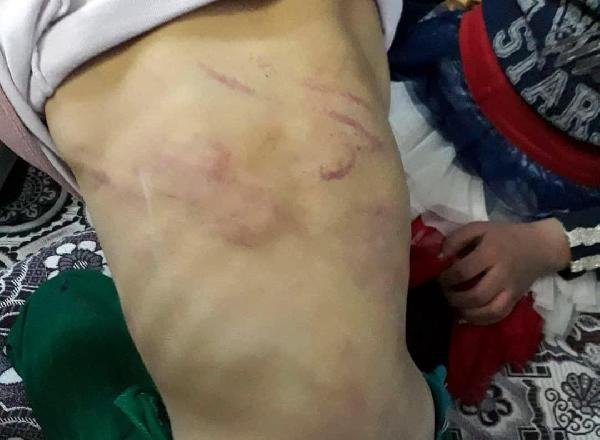 d Suriyeli baba kızına işkence yapıp dilendirdi