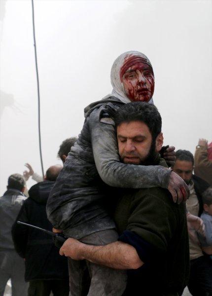 Suriye'nin başkenti Şam'ın Doğu Guta bölgesindeki Hamuriye beldesine düzenlenen hava saldırısında ilk belirlemelere göre 12 sivilin öldüğü, çok sayıda kişinin yaralandığı bildirildi. Saldırı sonucu yaralanan bir kız çocuğu, sivil savunma ekipleri tarafından bölgeden uzaklaştırıldı. (Tarih: 25/03/2017)