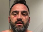 Beşiktaş İdari Sorumlusu'nu koridorda darp ettiler