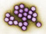 ABD'deki virüs salgını 6 çocuk öldü