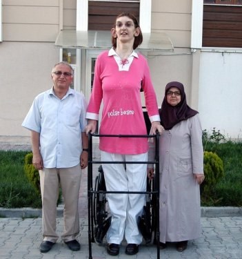 Dünyanın en uzun boylu kızı Rümeysa