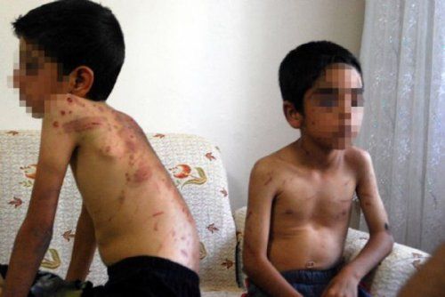 Bingöl'de şeker toplamaya giden çocuklara işkence