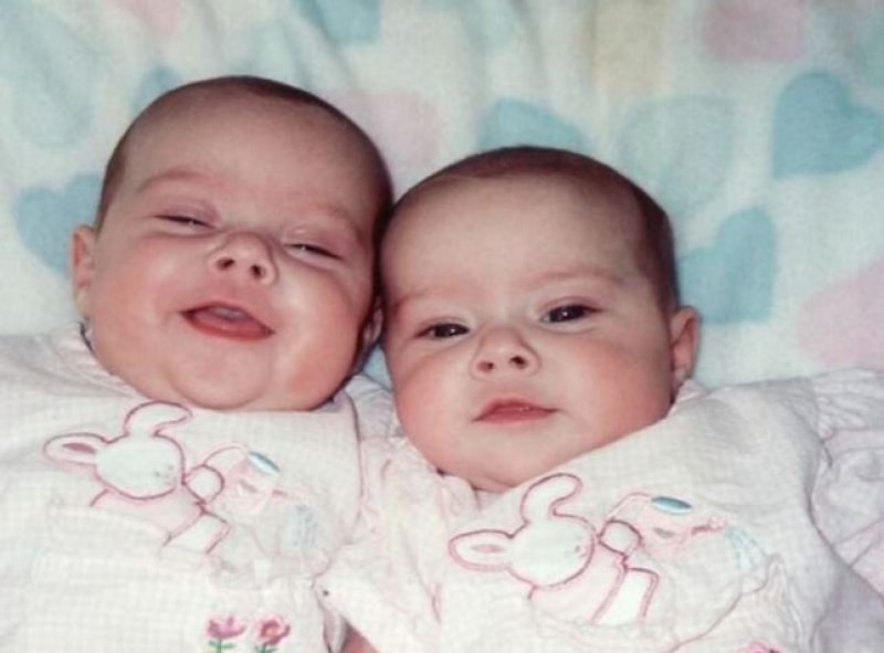 En güzel ikiz bebek fotoğrafları 
