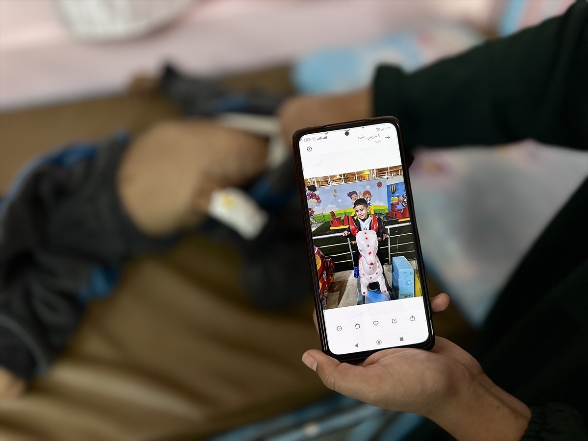 Gazze'de çocukların yetersiz beslenme vakaları giderek artıyor