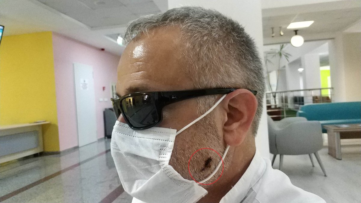 Samsun'da alkollü zabıta memuru kendisini vurdu
