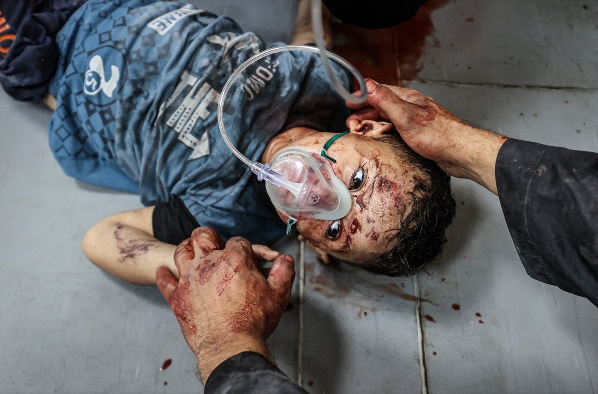 Gazze Yaralı Çocuk
