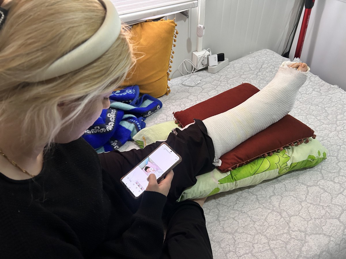 Hatay'da Depremzedelerin Zorlukları ve Biyonik Kol İhtiyacı