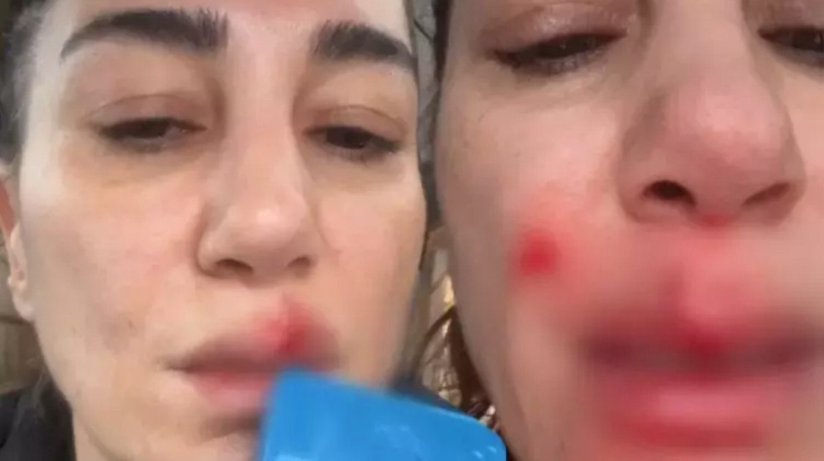 Nadide Sultan Kaza Geçirdi