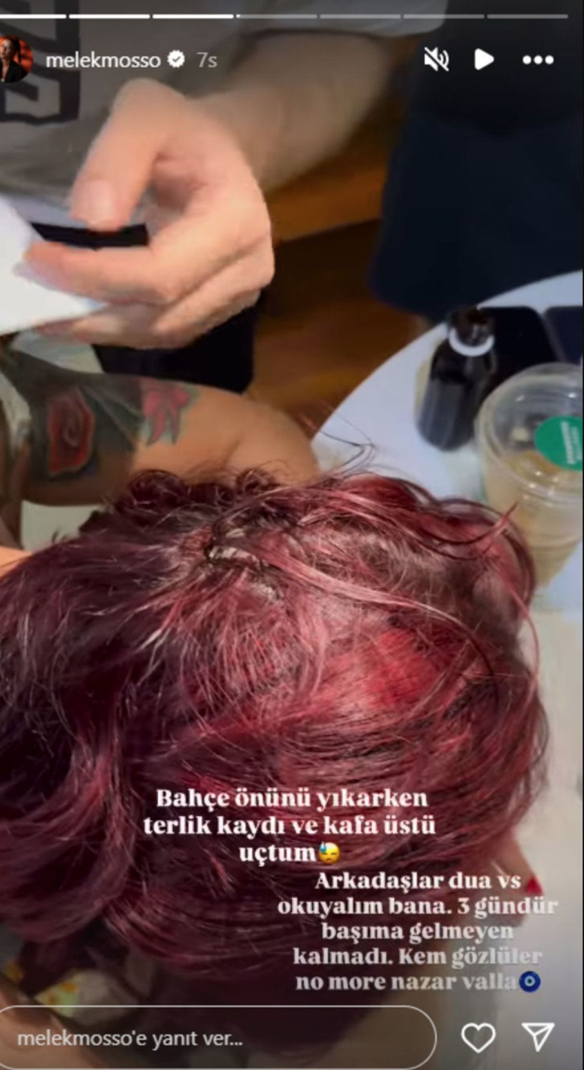 Şarkıcı Melek Mosso ev kazası geçirdi: 'Bana dua edin'