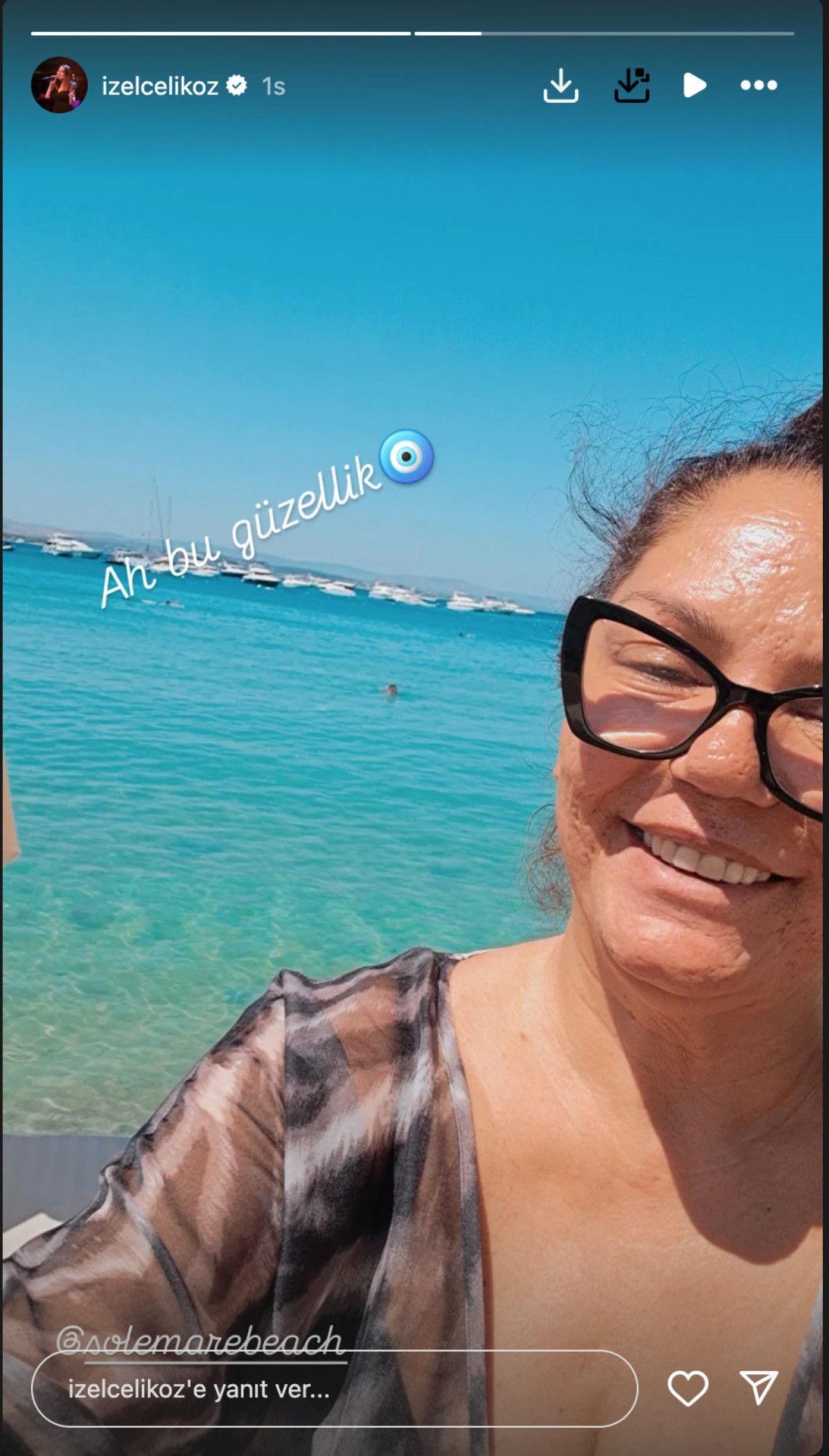 Ünlü şarkıcı İzel Photoshopsuz fotoğraf yayınladı: Selülitler gerçektir