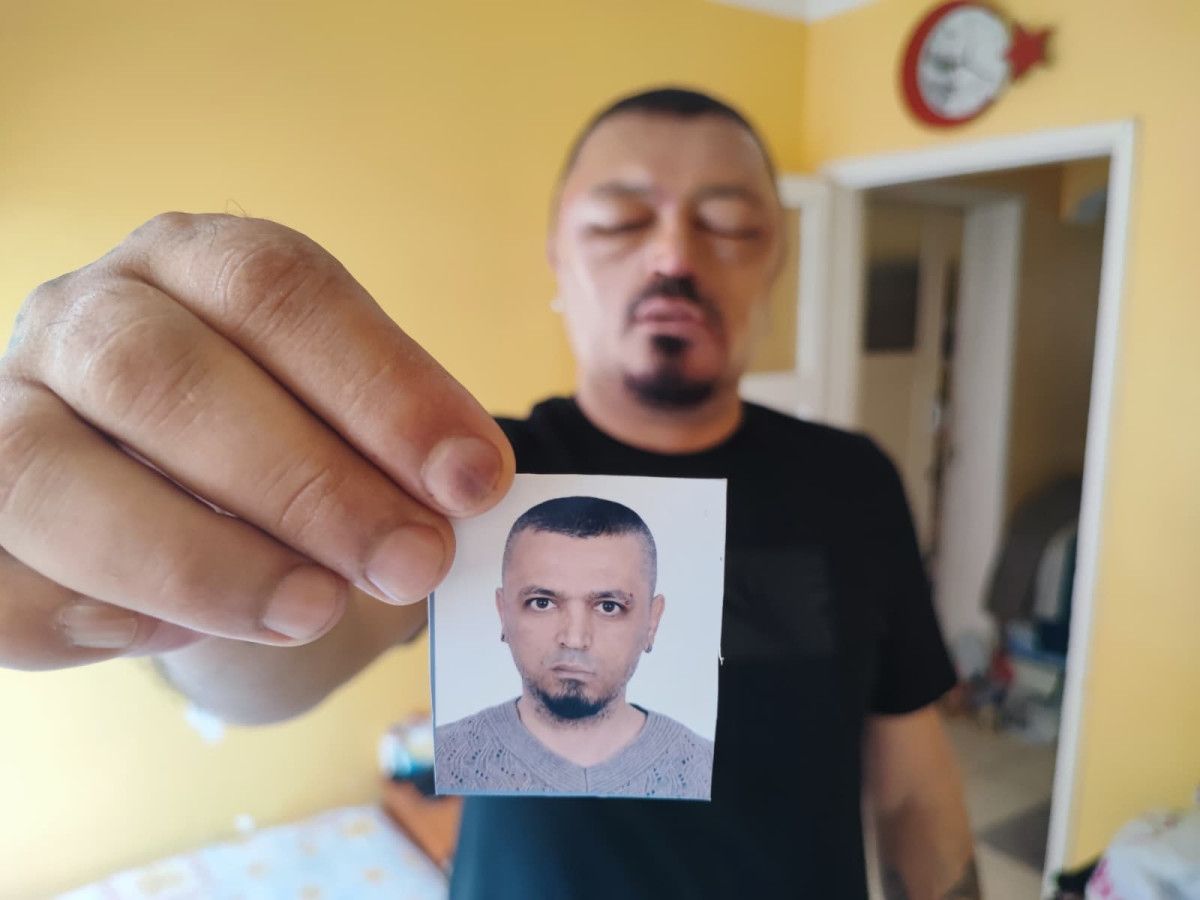 Siyah Saç için Satın Alınan Şampuanın Gözlerde ve Yüze Yarattığı Şok: Murat Gözde’nin Yaşadığı Olay