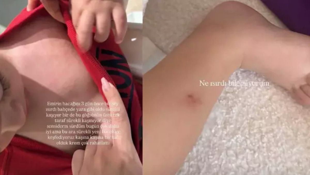 İdo Tatlıses ve Yasemin Şefkatli'nin İkizlerine Dair Yeni Gelişmeler