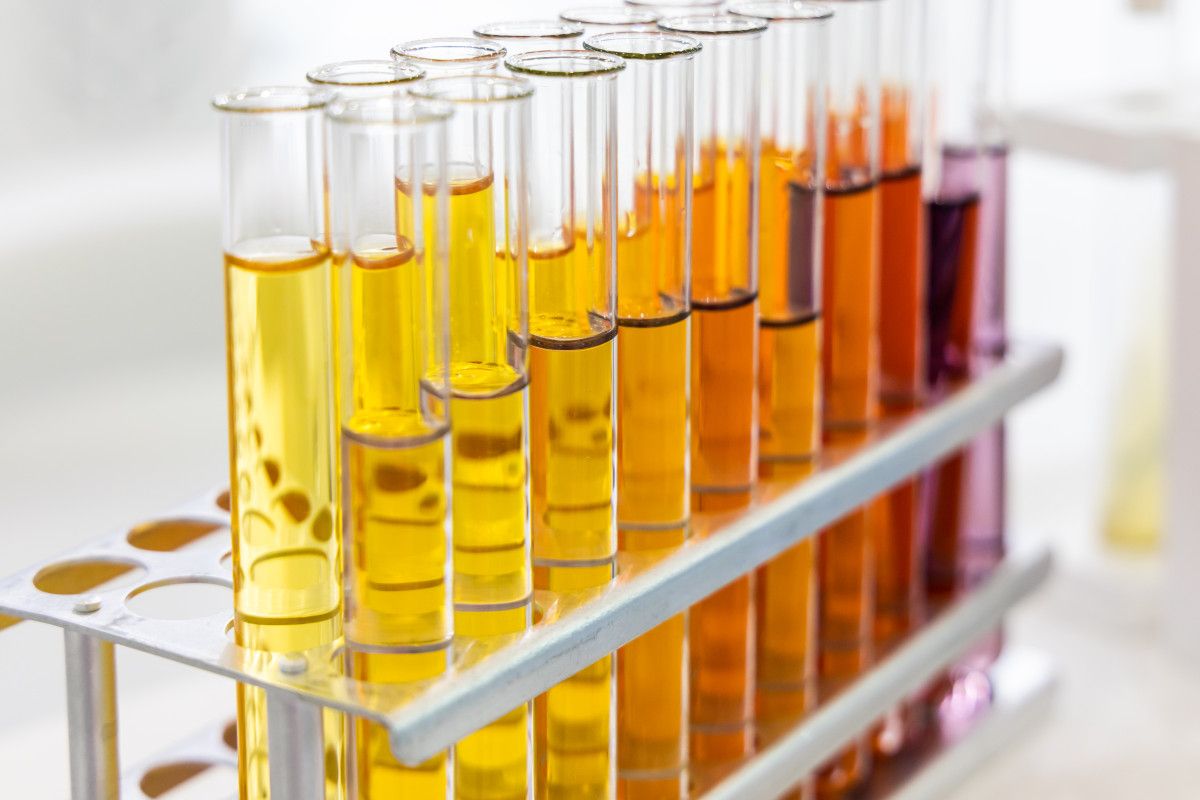 İdrar Rengine Göre Sağlık Uyarıları: Renkler ve Anlamları