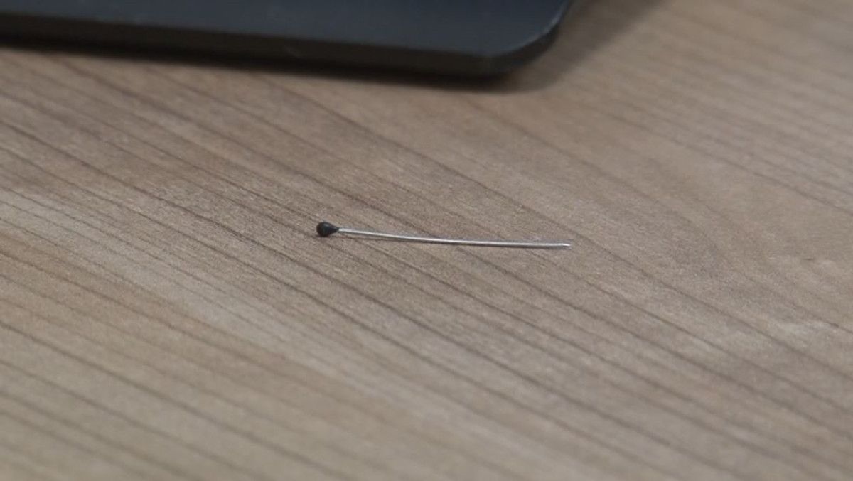 İğneyle Gelen Tehlike: 2 Yaşındaki Çocukta İnce Bağırsak Delinmesi ve Acil Ameliyat