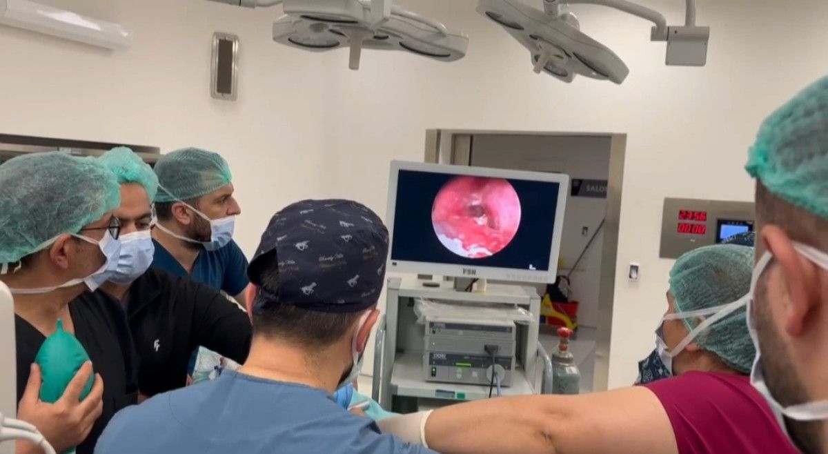 Yanık Ceviz Parçalarının Soluk Borusuna Girmesiyle Başlayan ama Yaşama Umudu Yitirilmeden Atılan Adımlar