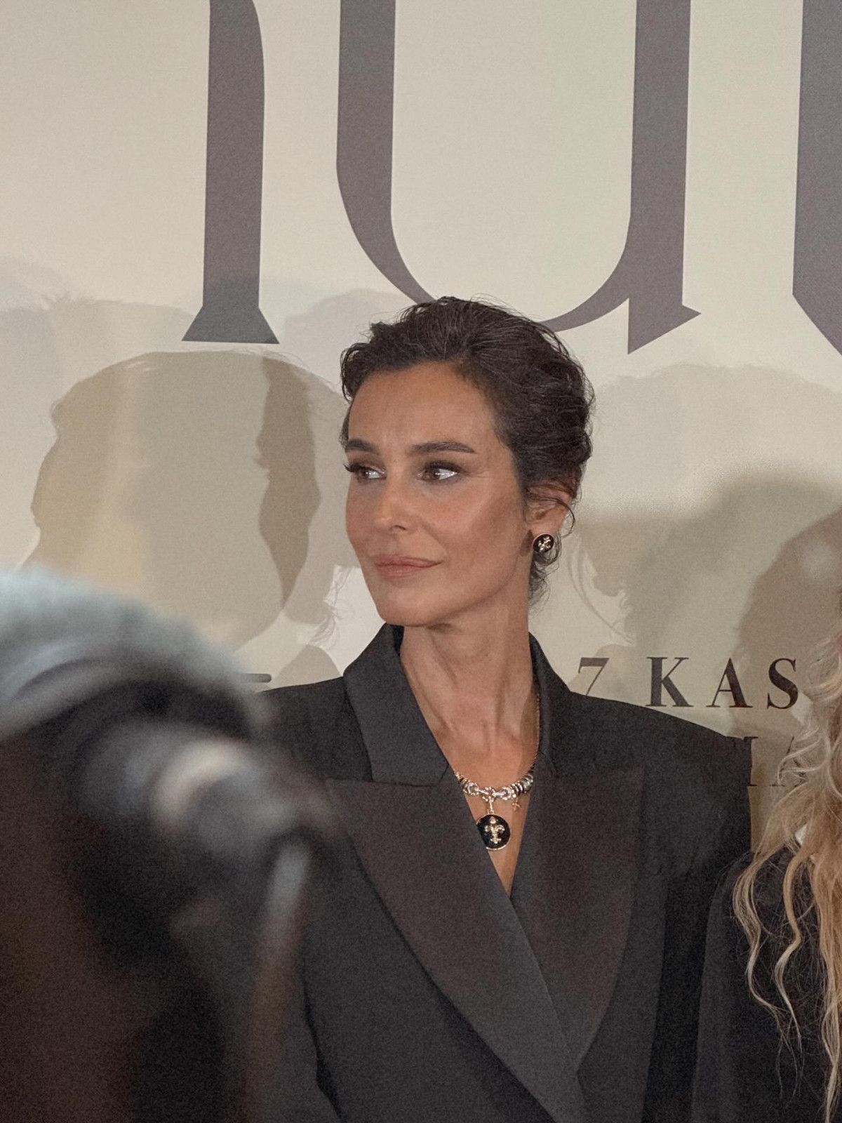 Arzum Onan: Estetiğe Karşı İçsel Travma ve Geçmişin Gölgesinde Yaşananlar