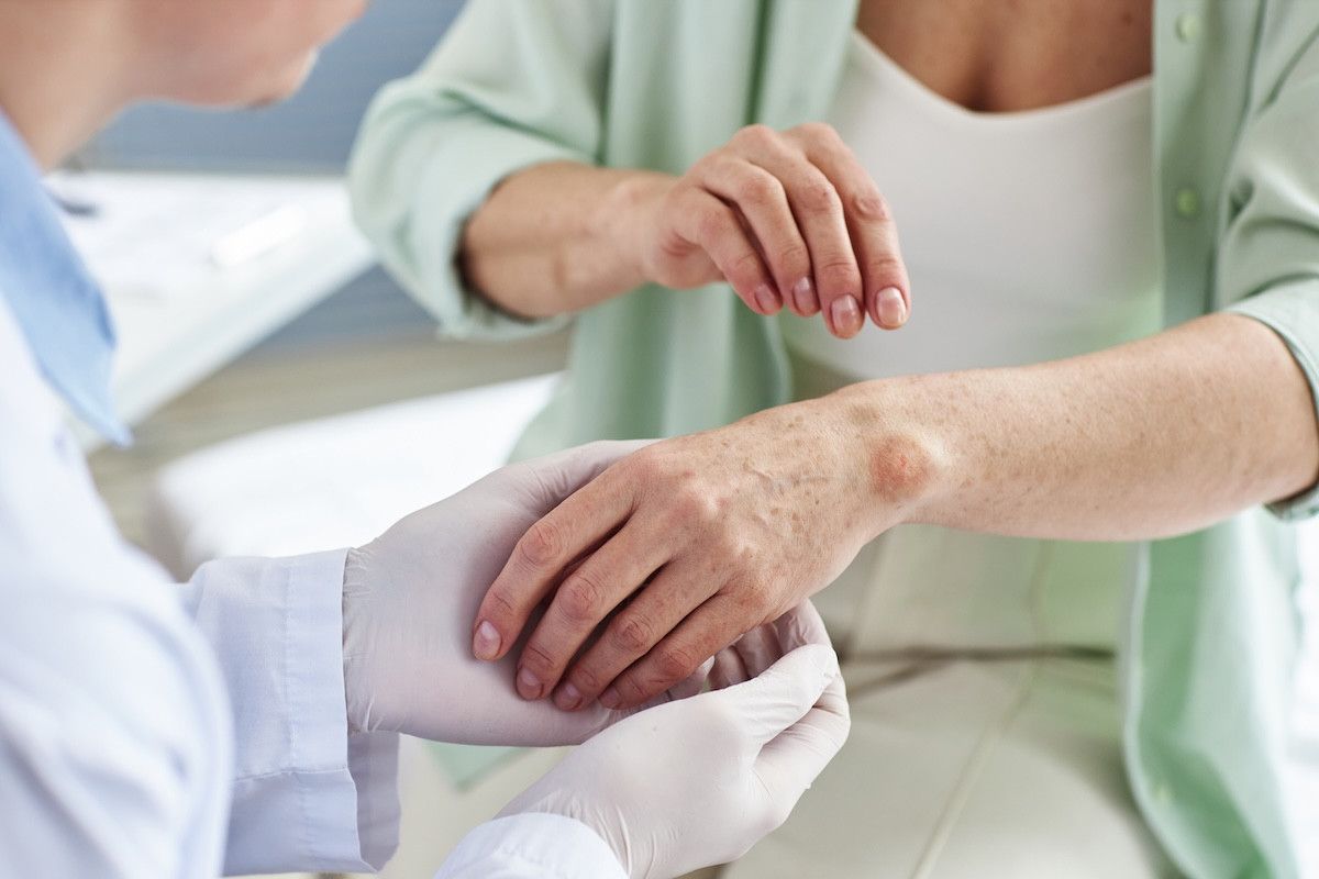 Kış D Vitamini: Dikkat Edilmesi Gerekenler ve Cilt Sağlığına Etkileri