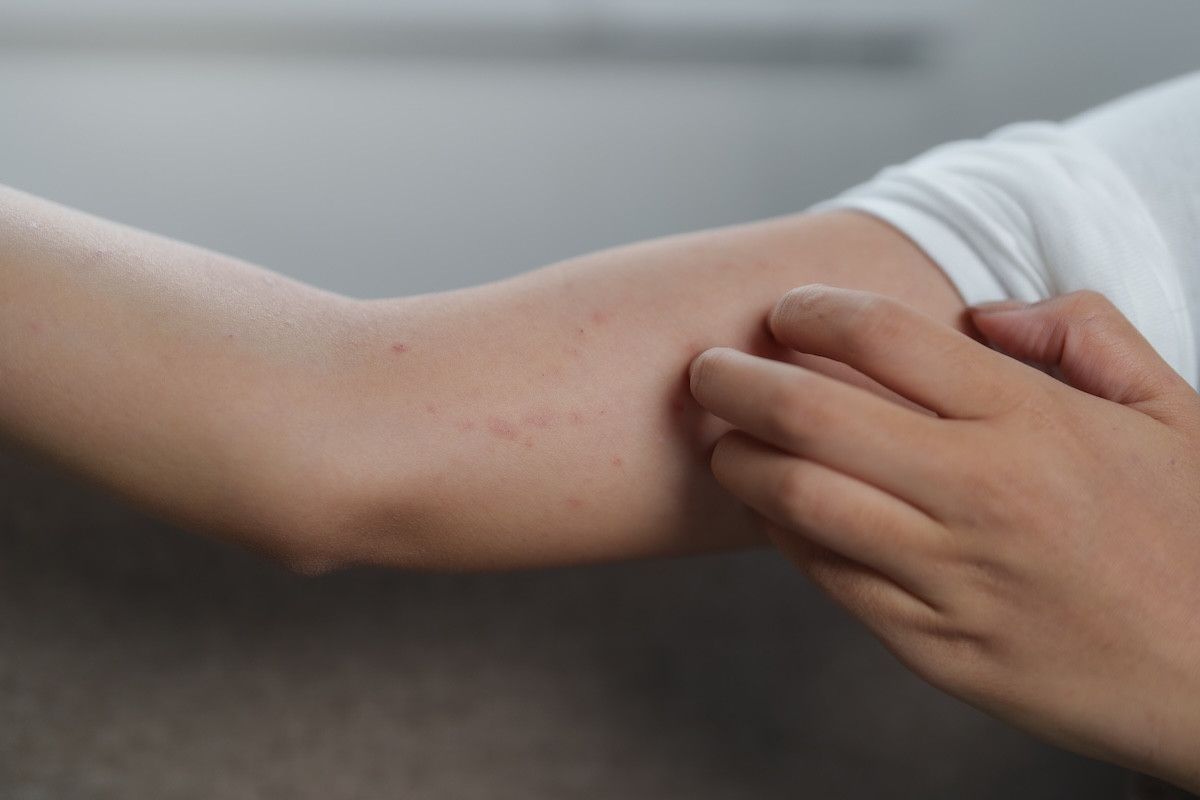 Kış D Vitamini: Dikkat Edilmesi Gerekenler ve Cilt Sağlığına Etkileri