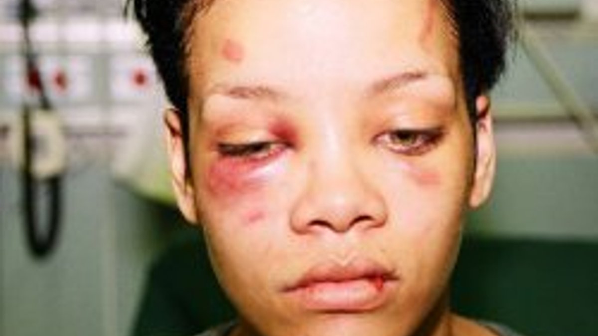 Kadına yönelik şiddet: Rihanna da risk altında