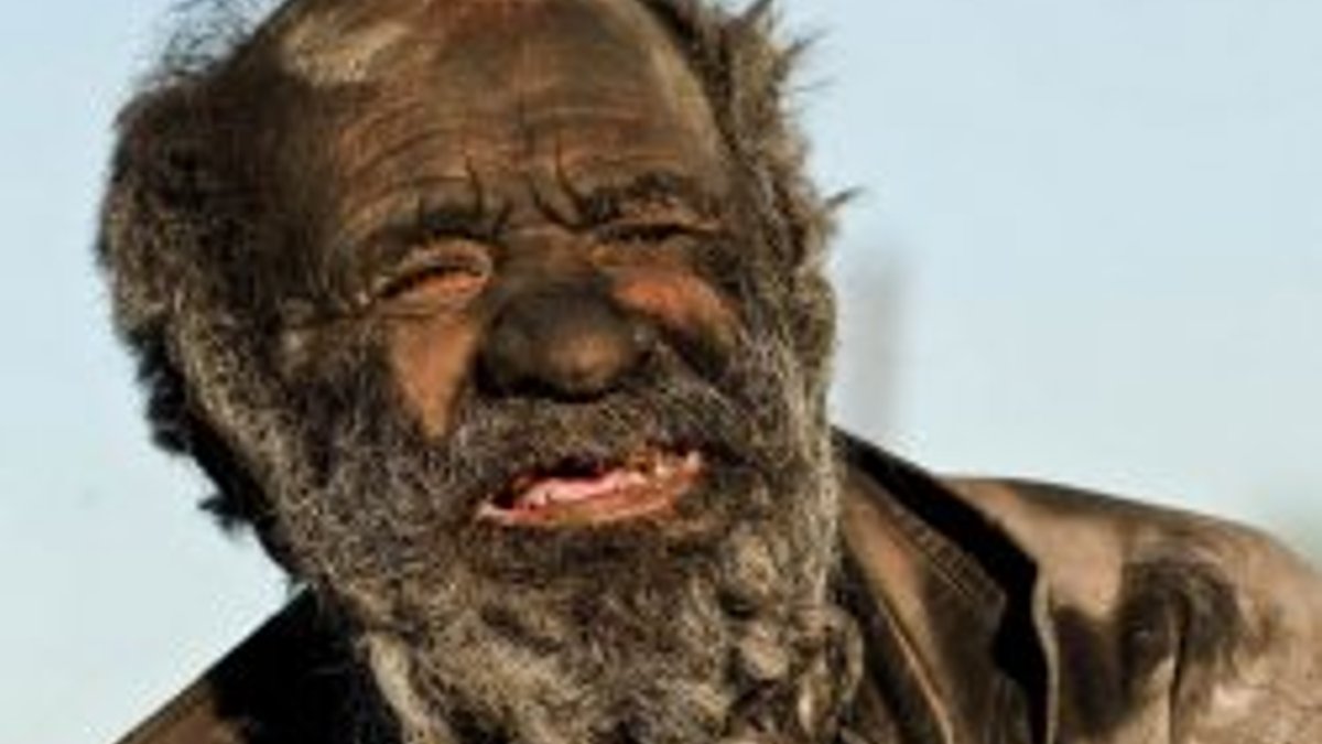 İran'da yaşayan bu adam 60 yıldır yıkanmıyor